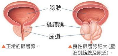 河池男性小便疼痛是怎么回事