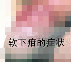 软下疳可出现的疾病变型？