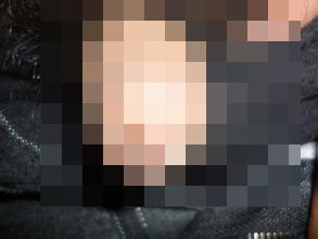 河池如何让淋病不在复发
