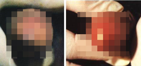 男性非淋是什么样的