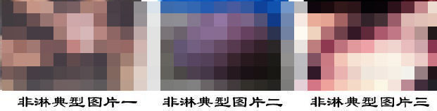 非淋的症状有哪些?